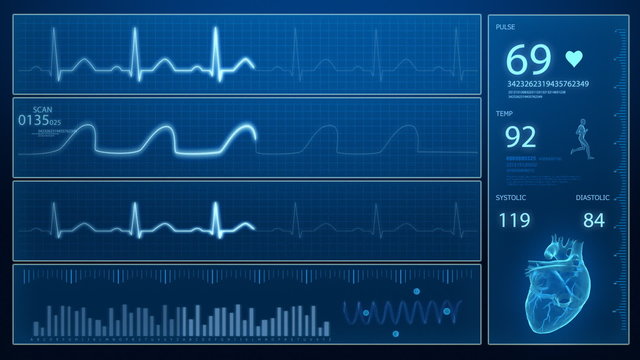 Heart beat monitor - ecg concept in loop