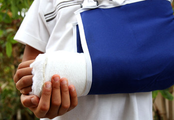 broken arm