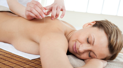 Obraz na płótnie Canvas Acupuncture needles on a beautiful woman's back