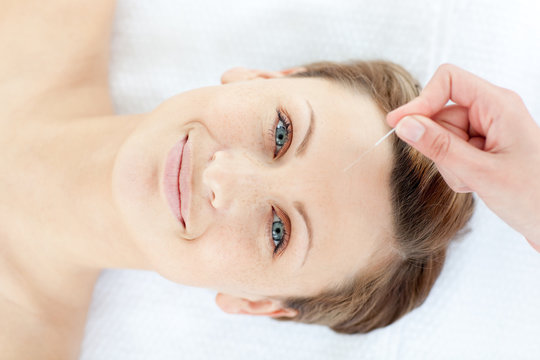 Portrait of a cheerful woman in acupuncture therapy