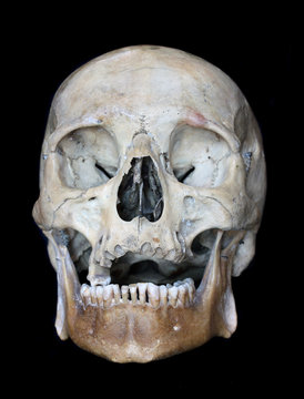 Skull of the person