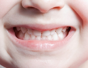 Child teeth