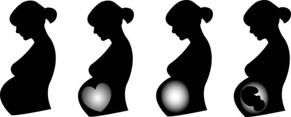 Illustration of pregnant profiles