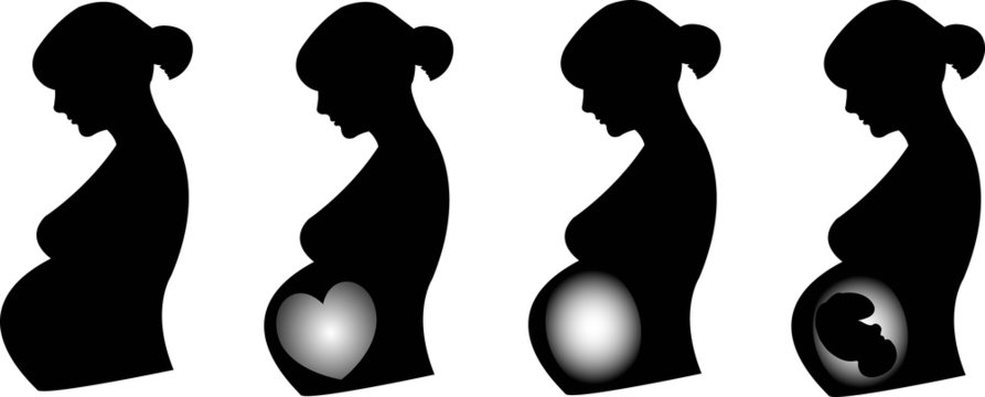 Illustration of pregnant profiles