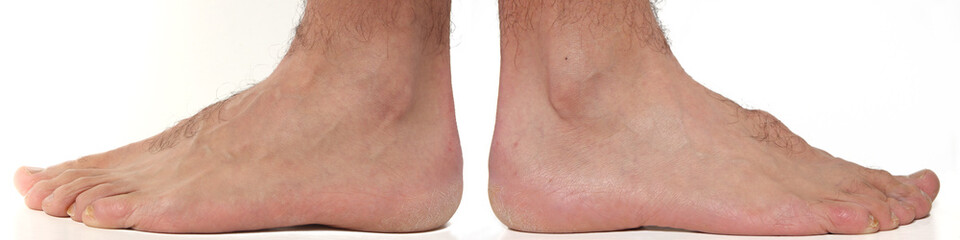 External Feet and ankle