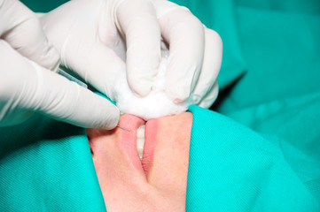 Fototapeta premium Woman receiving a botox