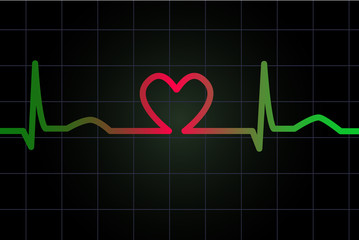 Heart rhythm