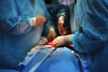 Surgery. Cancer ill women operation