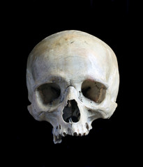 Skull of the person.