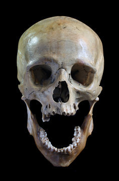 Skull of the person.