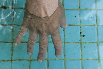 Hand im Wasserbad
