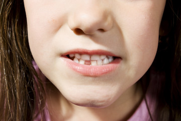 Obraz premium Small girl toothless smile close up