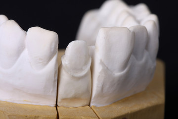 Fototapeta na wymiar wosk dentystyczny modelu detal