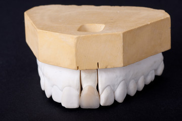 detail dental wax model