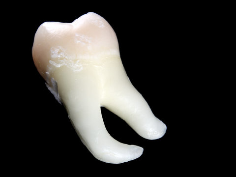 Isolated Wisdom Tooth