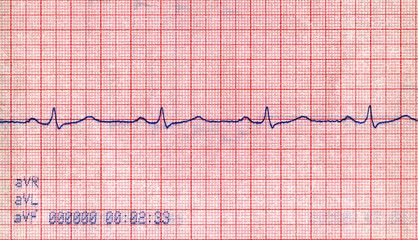 cardiovascular doppler diagram, cardio patient, clinic health care, cardiology diversity