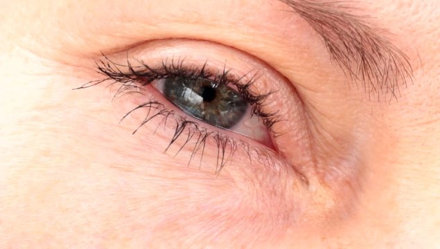cligner de l'oeil