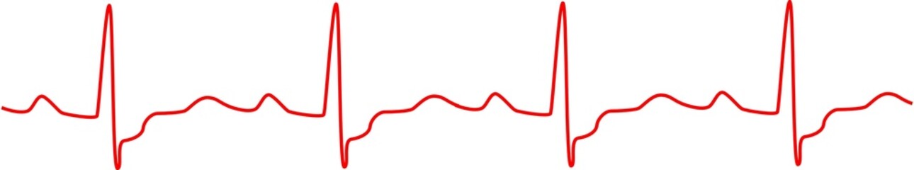 Heartbeat, heart monitor