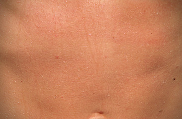 Fototapeta premium human skin