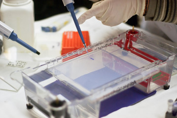 loading a sample into a gel for electrophoresis