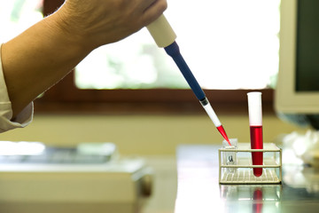 hand holding a pipette containing a blood sample