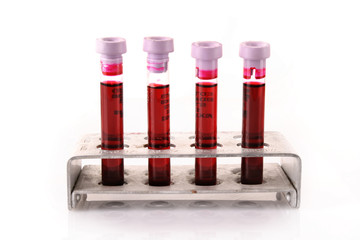 Medical test tubes with blood in holder on white background