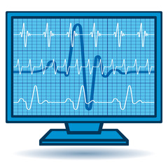 Cardiogram monitor