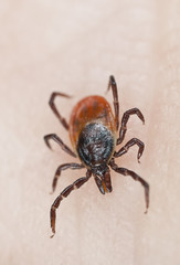 Tick crawling on human skin.