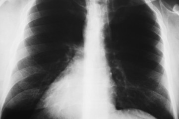 x-ray image