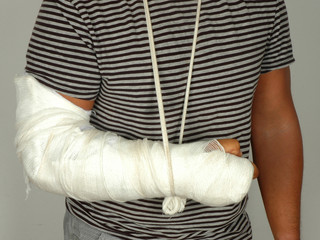 Broken arm