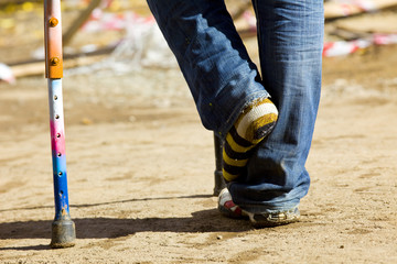 colour cruth and broken leg