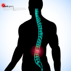 Back pain. Vector illustration.