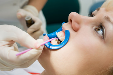 dental procedure of teeth protecting