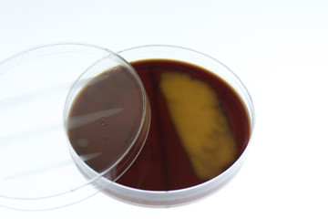 Bacterial growth on chocolate agar