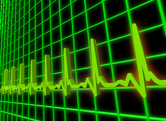 Ekg/ecg pulse diagram
