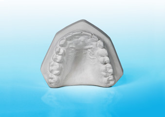 Upper jaw, plaster study model on blue background