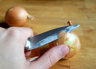 Zwiebeln mit Messer