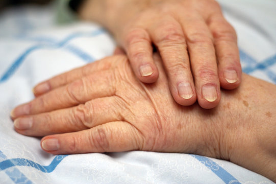 Hände einer pflegebedürftigen Person