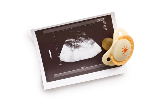 ultrasound photo with pacifier
