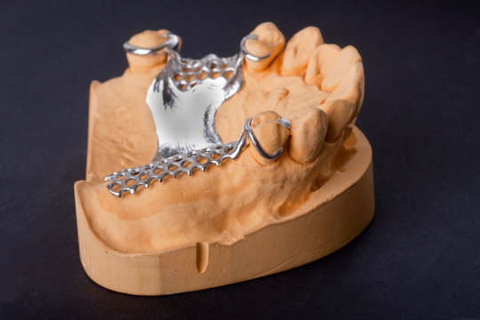 dental wax model