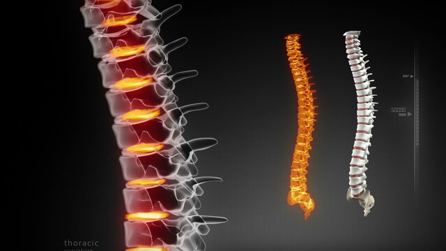 Human spine x-ray scan in loop