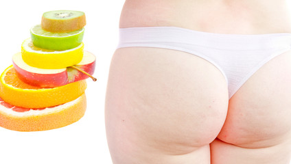 Cellulitis ass