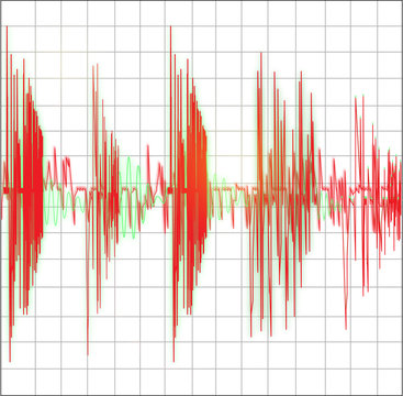 histogram