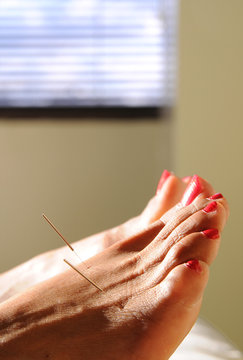 Acupuncture At The Foot