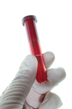 Blood examination