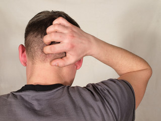 Man's hand scratching his head shaved,
