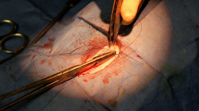 Suturing