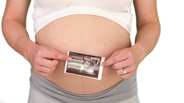 Woman showing us her pregnant scan
