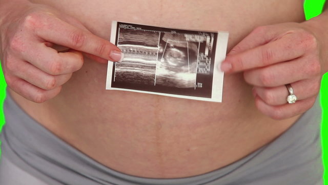 Expected woman showing us a scan of her future baby