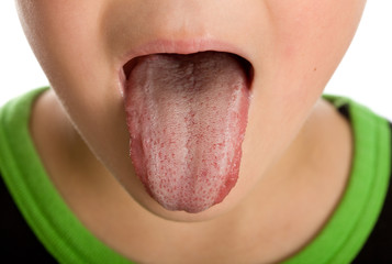 Unhealthy furred or coated tongue © Arpad Nagy-Bagoly
